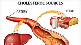 Alarming rise in Vietnamese population with high levels of cholesterol