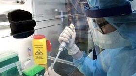 Samples are tested by Realtime PCR (Photo: VNA)