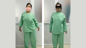 Phẫu thuật thành công một ca cong vẹo cột sống nặng, phức tạp