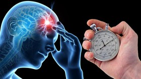 Gần 25% người đột quỵ sống phụ thuộc hoàn toàn vào người khác