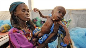 Trẻ em bị suy dinh dưỡng tại Tanout, nam Niger. Ảnh minh họa: AFP/TTXVN