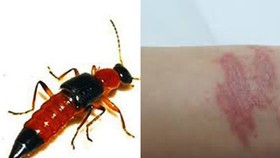 Cảnh báo kiến ba khoang tấn công người dân