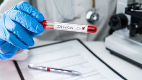 Hai người Iran tử vong sau khi phát hiện dương tính với COVID-19
