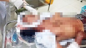 Con rể cầm rựa chém trọng thương cha và anh vợ