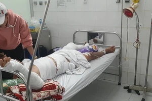  Nổ ghe lưới ghẹ ở Cà Mau, 3 người bị bỏng nặng