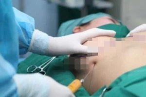 Vụ thai phụ tử vong sau khi nâng ngực: Bác sĩ phẫu thuật làm đúng!
