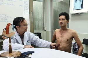 TS-BS Nguyễn Thái An đang thăm khám cho anh Huỳnh Thanh Hòa