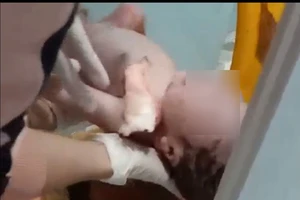 Bé trai sơ sinh được lấy ra từ thùng rác bệnh viện
