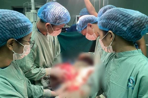 Quảng Ngãi: Phẫu thuật thành công khối u xơ nặng 5kg ở phụ nữ 47 tuổi