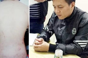 Đối tượng Trần Hoài Nam bị bắt giữ sau khi có hành vi bạo hành chính con trai