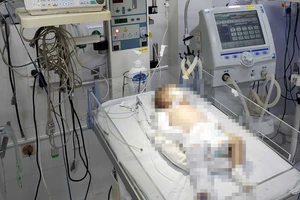 Bé sơ sinh 2 tháng tuổi nghi bị bạo hành nhập viện trong tình trạng nguy kịch