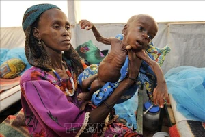 Trẻ em bị suy dinh dưỡng tại Tanout, nam Niger. Ảnh minh họa: AFP/TTXVN