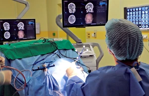 Ứng dụng kỹ thuật công nghệ cao định vị 3 chiều Navigation trong phẫu thuật xuất huyết trong não