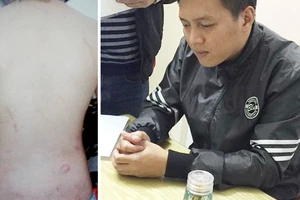 Đối tượng Trần Hoài Nam bị bắt giữ sau khi có hành vi bạo hành chính con trai
