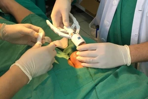 Bệnh nhân tai biến nặng sau thủ thuật cắt bao quy đầu ở bệnh viện tuyến trung ương