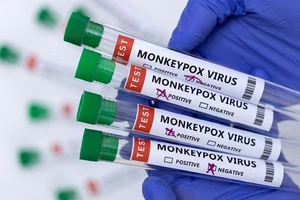 Có nên tiêm vaccine đậu mùa khỉ sau khi Việt Nam đã có ca mắc?