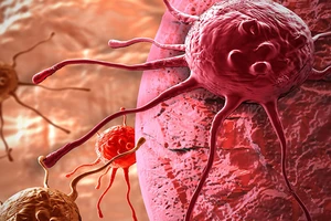 Thiết bị lai sinh học có thể giúp chẩn đoán sớm ung thư và bệnh lao. Ảnh: SPUTNIKNEWS. COM 
