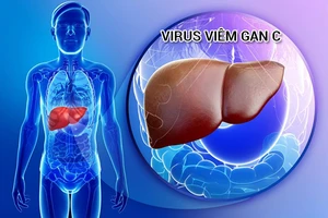 Tầm soát viêm gan và phát hiện sớm bệnh lý đái tháo đường