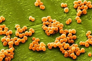 42% số vụ ngộ độc thực phẩm do vi sinh vật là vi khuẩn tụ cầu vàng
