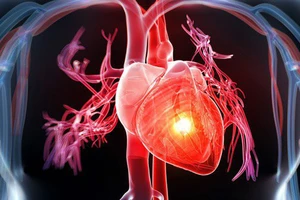 Phòng tránh các bệnh tim mạch chuyển hóa