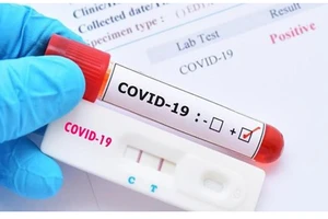 Có thể xác định mắc Covid-19 qua triệu chứng bệnh, dù kết quả xét nghiệm PCR âm tính