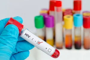 Canada mở rộng xét nghiệm HIV
