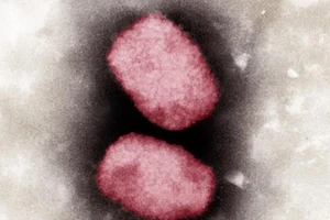 WHO nghiên cứu khả năng đột biến gene của virus gây bệnh đậu mùa khỉ