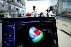 Công nghệ mới giúp cảnh báo sớm bệnh đau tim