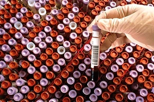 Trung Quốc điều tra vụ hơn 12.000 chai huyết tương nhiễm HIV