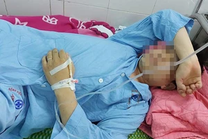 Anh Vũ Văn Pho điều trị ở bệnh viện sau khi bị đánh. Ảnh: Thanh Nien Online