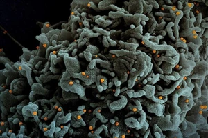 Hình ảnh dưới kính hiển vi một tế bào (màu xanh) của bệnh nhân Covid-19 bị nhiễm biến thể B.1.1.7 của virus SARS-CoV-2 (màu vàng). Ảnh: AFP/TTXVN