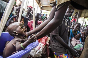 Kiểm tra sức khỏe cho trẻ em suy dinh dưỡng tại Panthau, Nam Sudan. Ảnh tư liệu: AFP/TTXVN