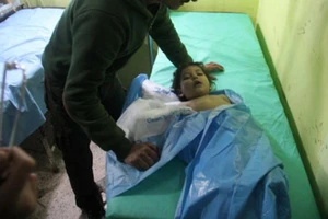 Một em nhỏ được điều trị vì ảnh hưởng của vũ khí hóa học trong vụ tấn công khả Khan Sheikhun, Syria, tháng 4-2017. Ảnh: UPI