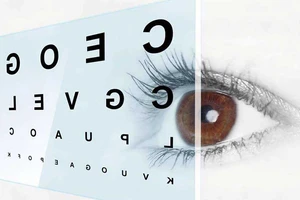 5 loại bệnh lớn về mắt - giải quyết nhẹ nhàng chỉ trong 3 tuần!