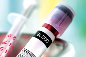 Tầm soát ung thư bằng xét nghiệm máu