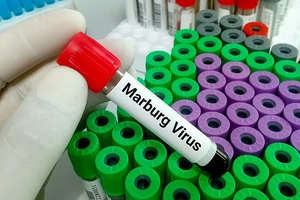 Bùng phát virus Marburg ở Tanzania