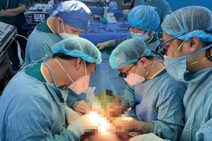 Các bác sĩ thực hiện ca phẫu thuật. Ảnh: www.hcmcpv.org.vn