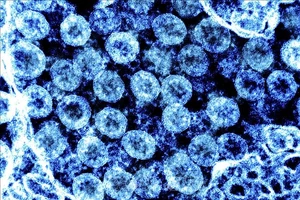 Hình ảnh từ kính hiển vi do Viện nghiên cứu bệnh truyền nhiễm và dị ứng quốc gia Mỹ cung cấp cho thấy virus SARS-CoV-2 trong mẫu bệnh phẩm của bệnh nhân mắc Covid-19. Ảnh minh họa: AFP/TTXVN