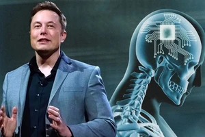 Dự án Neuralink của tỷ phú Elon Musk gây tranh cãi
