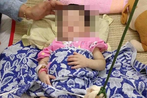 Bé gái 2 tuổi bị mẹ nuôi đánh gãy chân