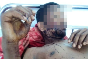 Y Trang Niê bị trúng đạn đang được điều trị tại Trung tâm Y tế huyện Cư M'gar
