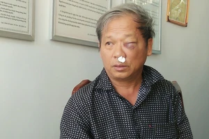 Phóng viên bị đánh dã man sau khi báo tin khai thác đất trái phép