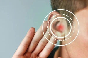 Phát hiện mTORC2 trong tai người mở ra hướng điều trị điếc