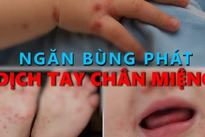 Ngăn bùng phát dịch tay chân miệng