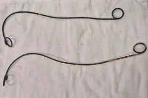 Phẫu thuật lấy 2 ống thông JJ bị bỏ quên trong cơ thể bệnh nhân hơn 10 năm