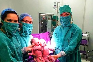 Medical workers with the twins  (photo: SGGP)