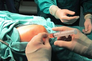 A joint replacement operation (Photo: SGGP)
