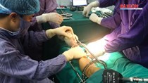 Vietnamese surgeons lengthen leg to 10 cm