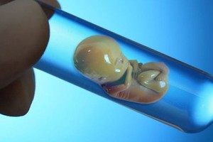 Surrogacy for commercial purposes more complicated