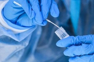 Residents should watch out for JN.1 Omicron sub-variant amid severe cold wave